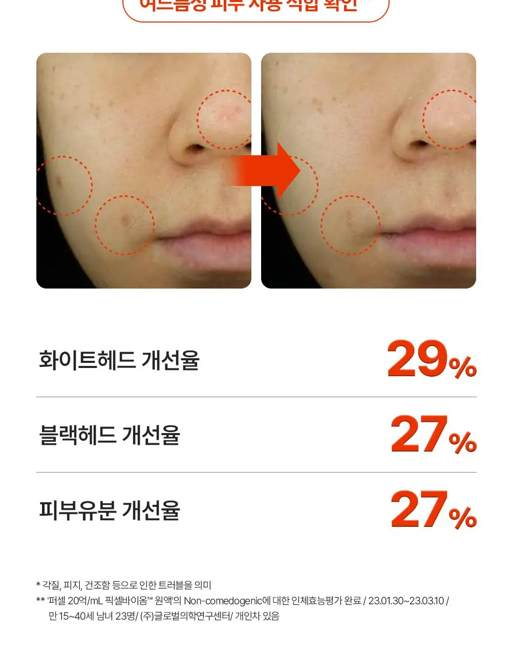 [장벽강화세럼] 퍼셀 20억/mL 픽셀바이옴 유산균 원액 20ml 상세페이지 16